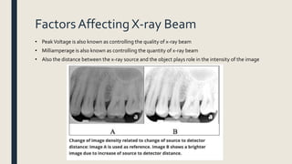 Factors Affecting X-ray Beam
• PeakVoltage is also known as controlling the quality of x-ray beam
• Milliamperage is also known as controlling the quantity of x-ray beam
• Also the distance between the x-ray source and the object plays role in the intensity of the image
 