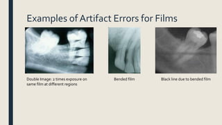 Examples of Artifact Errors for Films
Double Image: 2 times exposure on
same film at different regions
Bended film Black line due to bended film
 