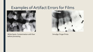 Examples of Artifact Errors for Films
White Spots: Contamination with fixer
before processing
Smudge: Finger Prints
 