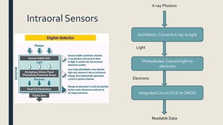 Intraoral Sensors
Scintillator:Converts X-ray to light
Photodiodes: Convert light to
electrons
Integrated Circuit (CCD or CMOS)
X-ray Photons
Light
Electrons
Readable Data
 
