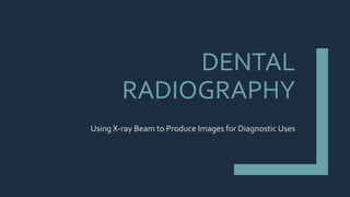 DENTAL
RADIOGRAPHY
Using X-ray Beam to Produce Images for Diagnostic Uses
 