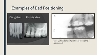 Examples of Bad Positioning
Cone Cutting: Cone not positioned toward the
receptor well
 