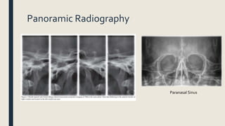 Panoramic Radiography
Paranasal Sinus
 
