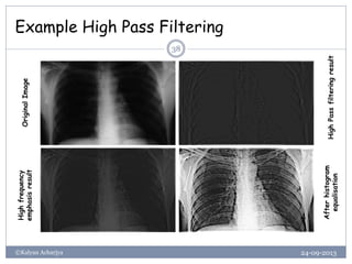 Example High Pass Filtering
24-09-2013©Kalyan Acharjya
38
OriginalImage
HighPassfilteringresult
Highfrequency
emphasisresult
Afterhistogram
equalisation
 