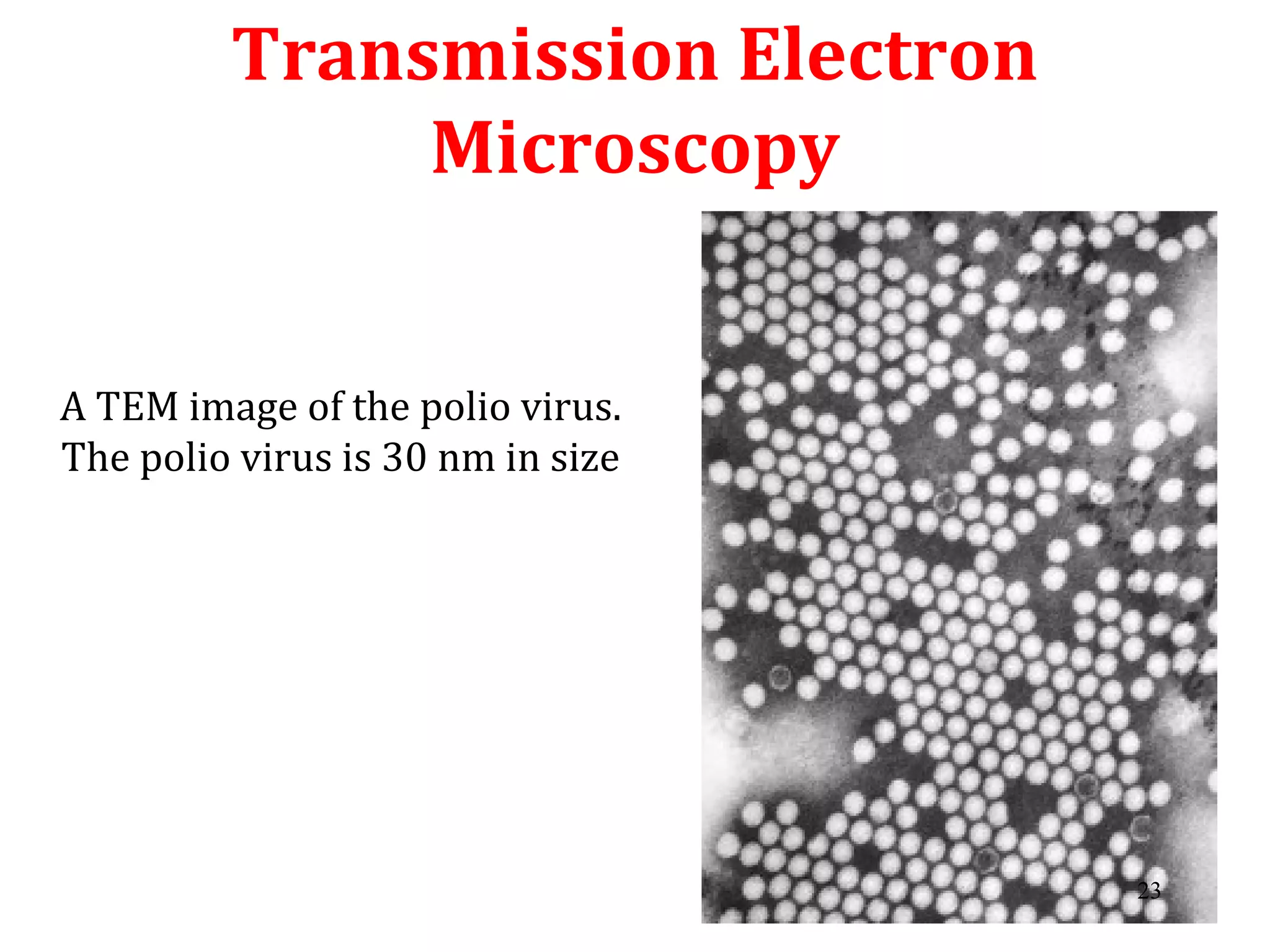 Transmission Electron
Microscopy
A TEM image of the polio virus.
The polio virus is 30 nm in size
23
 