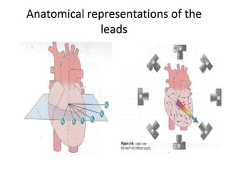 Anatomical representations of the
leads

 