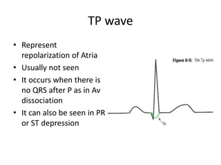 TP wave
• Represent
repolarization of Atria
• Usually not seen
• It occurs when there is
no QRS after P as in Av
dissociation
• It can also be seen in PR
or ST depression

 