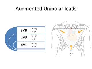 Augmented Unipolar leads

aVR

• +ve
• RA

aVF

• +ve
• Lf

aVL

• +ve
• LA

 