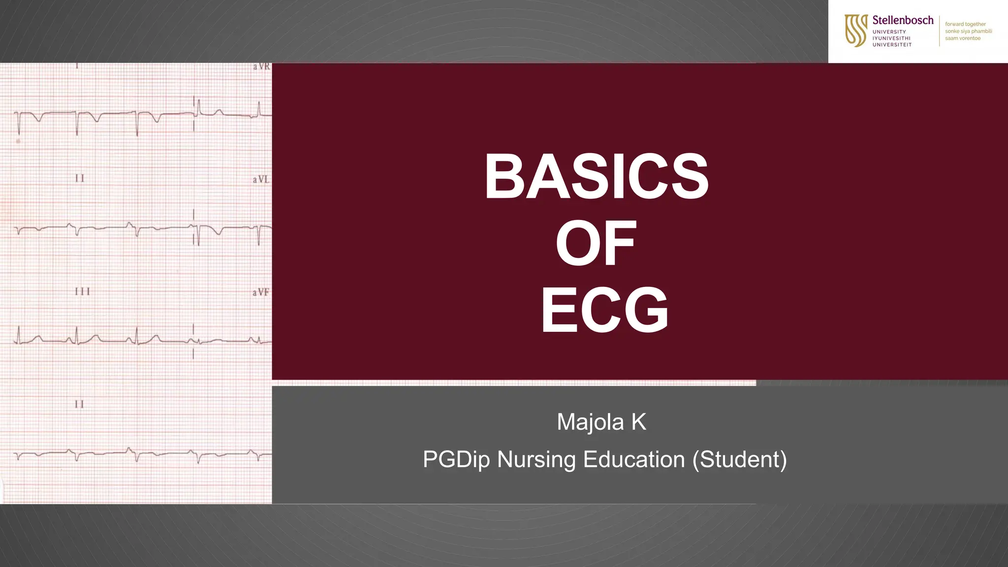 INTRODUCTION TO ECG (ELECTROCARDIOGRAM) EKG | PPTX