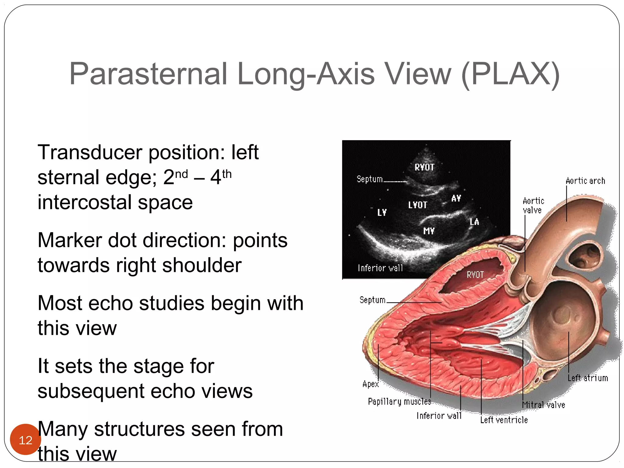 Parasternal Long-Axis View (PLAX) 
12 
Transducer position: left 
sternal edge; 2nd – 4th 
intercostal space 
Marker dot direction: points 
towards right shoulder 
Most echo studies begin with 
this view 
It sets the stage for 
subsequent echo views 
Many structures seen from 
this view 
 