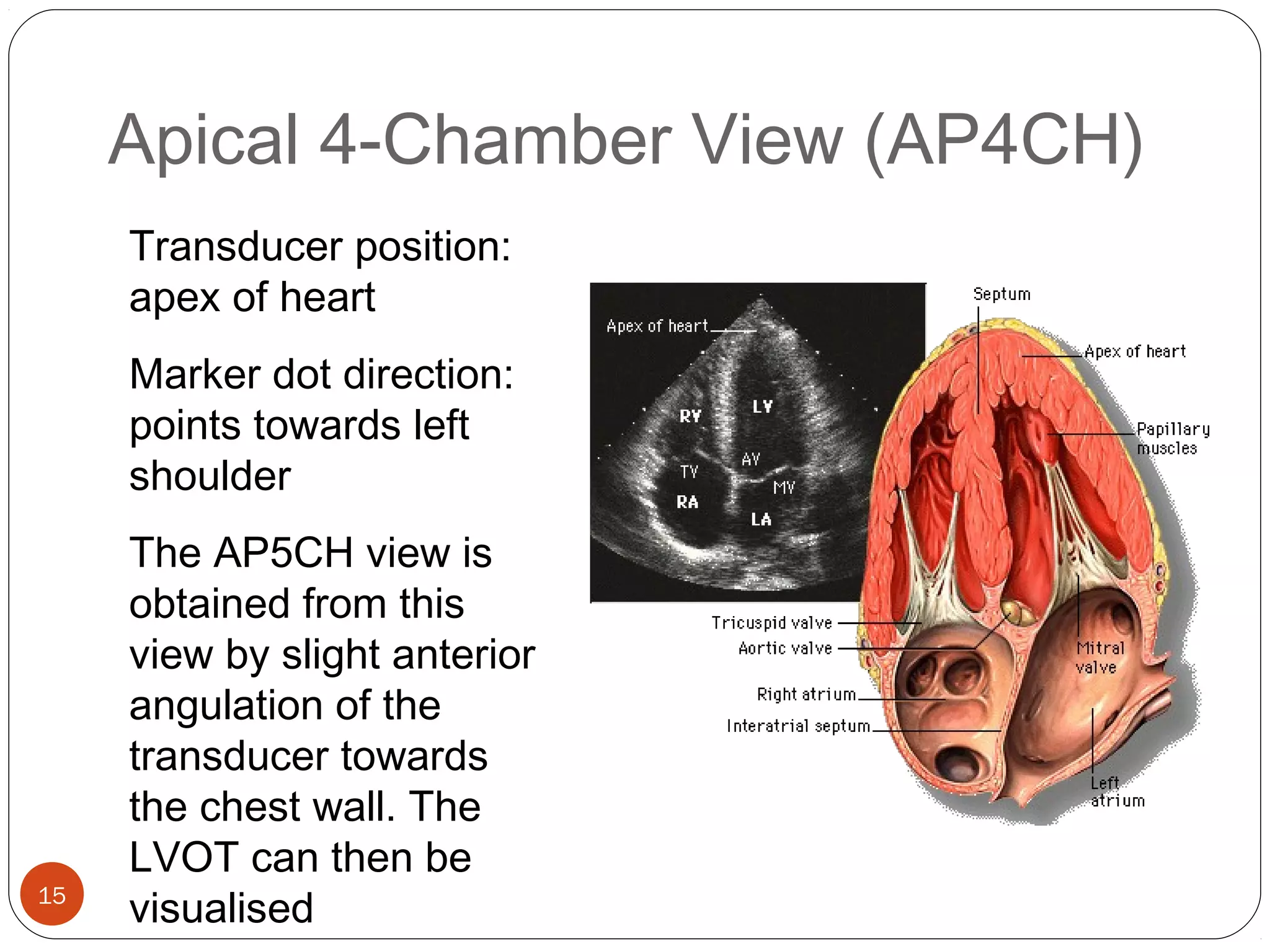 Apical 4-Chamber View (AP4CH) 
15 
Transducer position: 
apex of heart 
Marker dot direction: 
points towards left 
shoulder 
The AP5CH view is 
obtained from this 
view by slight anterior 
angulation of the 
transducer towards 
the chest wall. The 
LVOT can then be 
visualised 
 