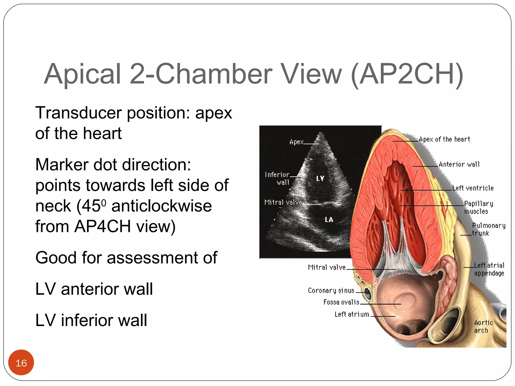 Apical 2-Chamber View (AP2CH) 
16 
Transducer position: apex 
of the heart 
Marker dot direction: 
points towards left side of 
neck (450 anticlockwise 
from AP4CH view) 
Good for assessment of 
LV anterior wall 
LV inferior wall 
 