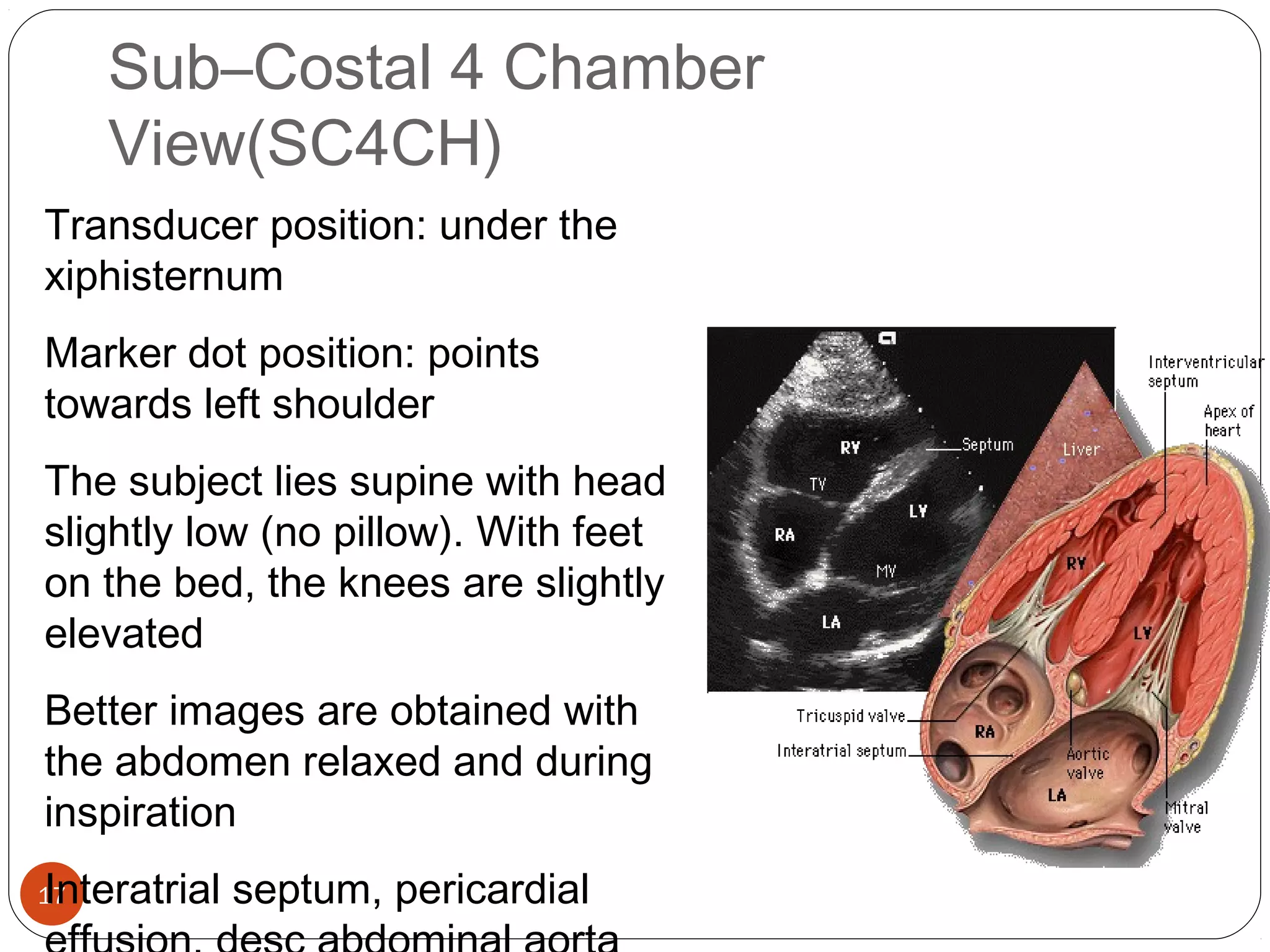 Sub–Costal 4 Chamber 
View(SC4CH) 
Transducer position: under the 
xiphisternum 
Marker dot position: points 
towards left shoulder 
The subject lies supine with head 
slightly low (no pillow). With feet 
on the bed, the knees are slightly 
elevated 
Better images are obtained with 
the abdomen relaxed and during 
inspiration 
Interatrial septum, pericardial 
effusion, desc abdominal aorta 
17 
 