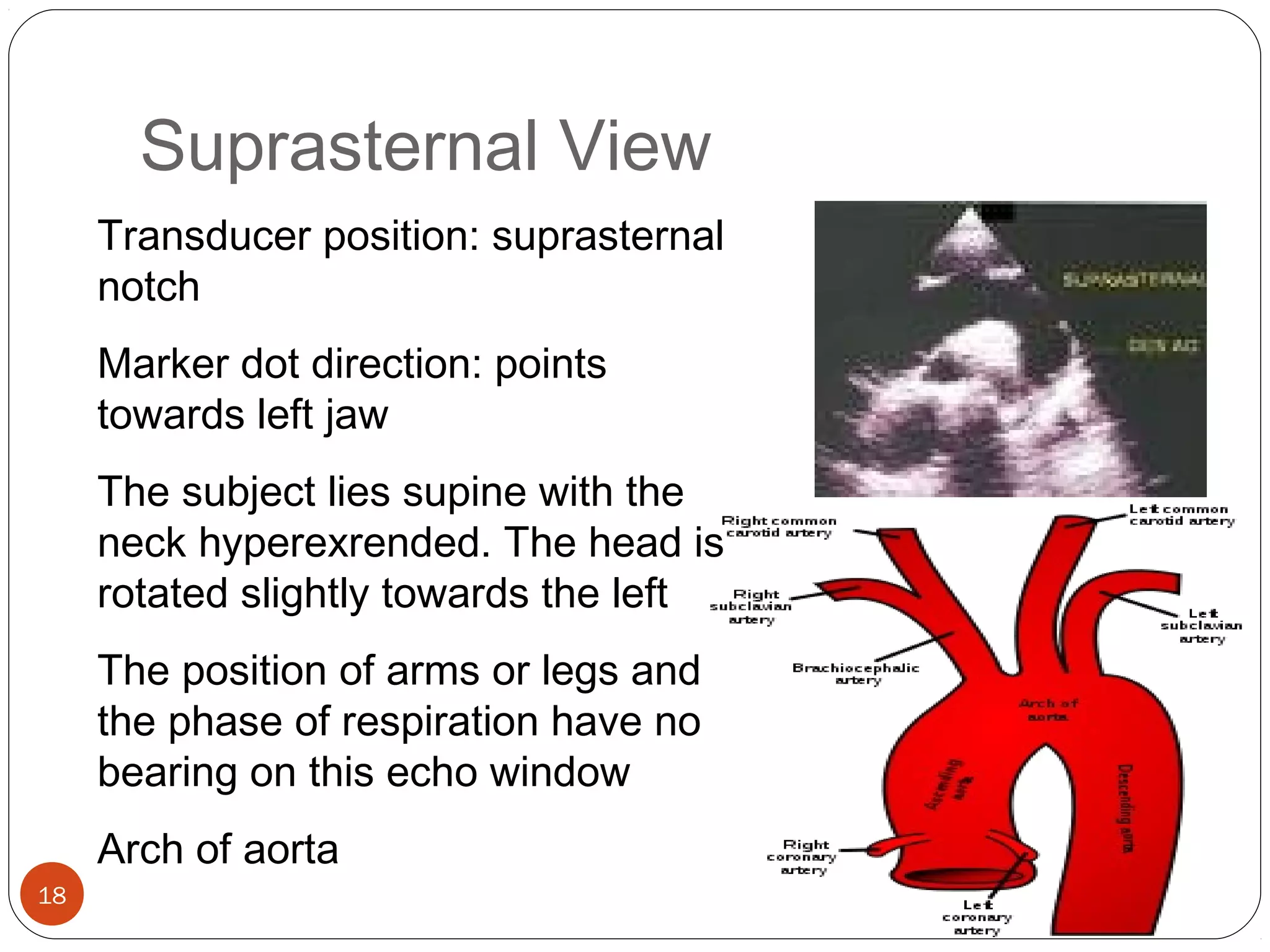 Suprasternal View 
18 
Transducer position: suprasternal 
notch 
Marker dot direction: points 
towards left jaw 
The subject lies supine with the 
neck hyperexrended. The head is 
rotated slightly towards the left 
The position of arms or legs and 
the phase of respiration have no 
bearing on this echo window 
Arch of aorta 
 