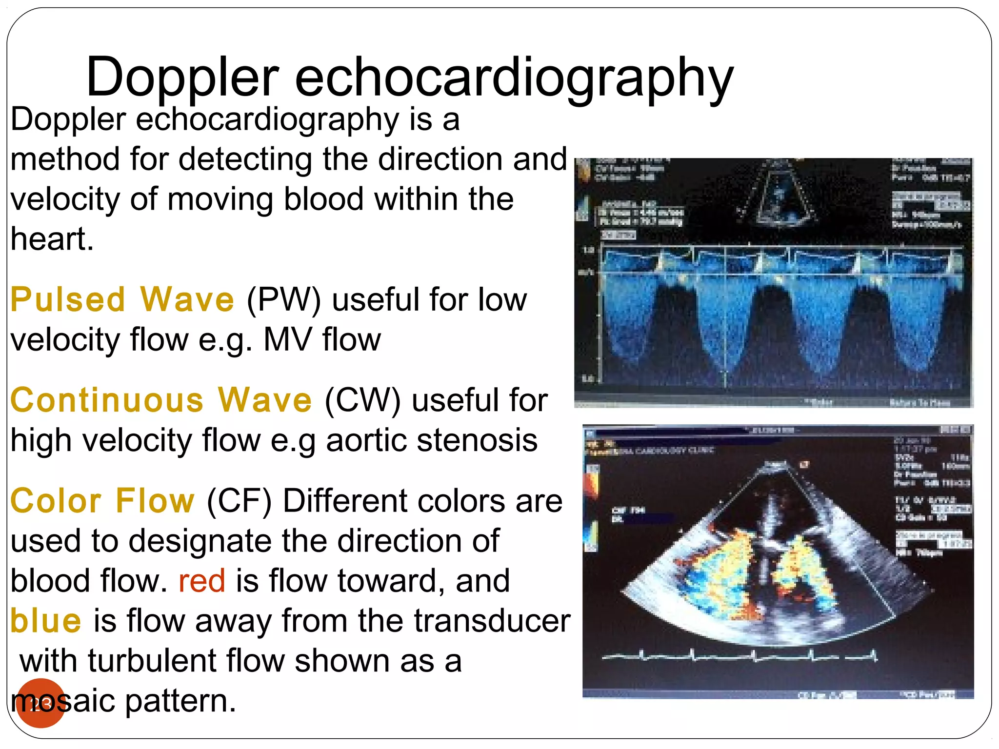 Doppler echocardiography 
Doppler echocardiography is a 
method for detecting the direction and 
velocity of moving blood within the 
heart. 
Pulsed Wave (PW) useful for low 
velocity flow e.g. MV flow 
Continuous Wave (CW) useful for 
high velocity flow e.g aortic stenosis 
Color Flow (CF) Different colors are 
used to designate the direction of 
blood flow. red is flow toward, and 
blue is flow away from the transducer 
with turbulent flow shown as a 
mosaic 23 
pattern. 
 