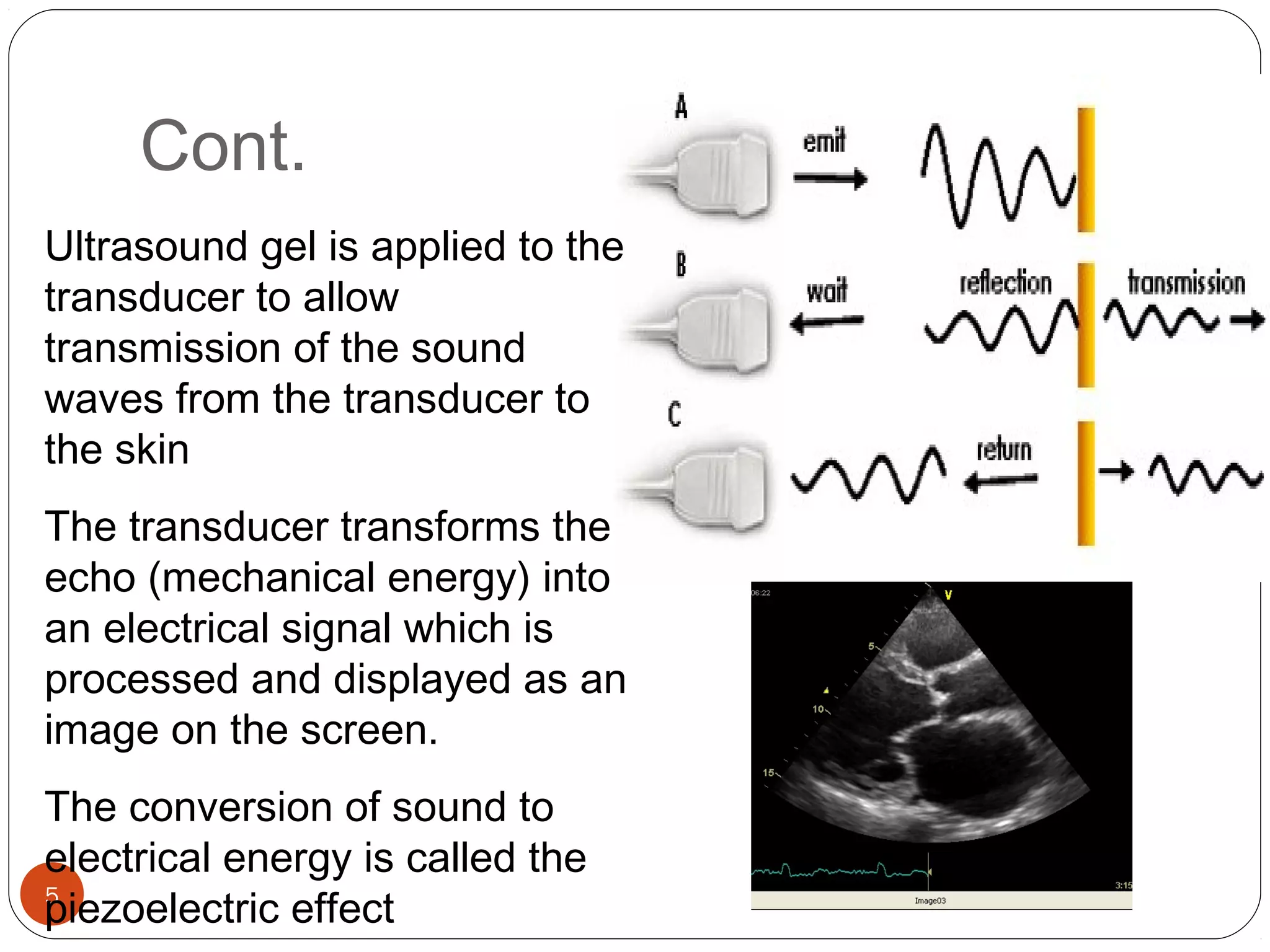 Cont. 
Ultrasound gel is applied to the 
transducer to allow 
transmission of the sound 
waves from the transducer to 
the skin 
The transducer transforms the 
echo (mechanical energy) into 
an electrical signal which is 
processed and displayed as an 
image on the screen. 
The conversion of sound to 
electrical energy is called the 
piezoelectric 5 
effect 
 