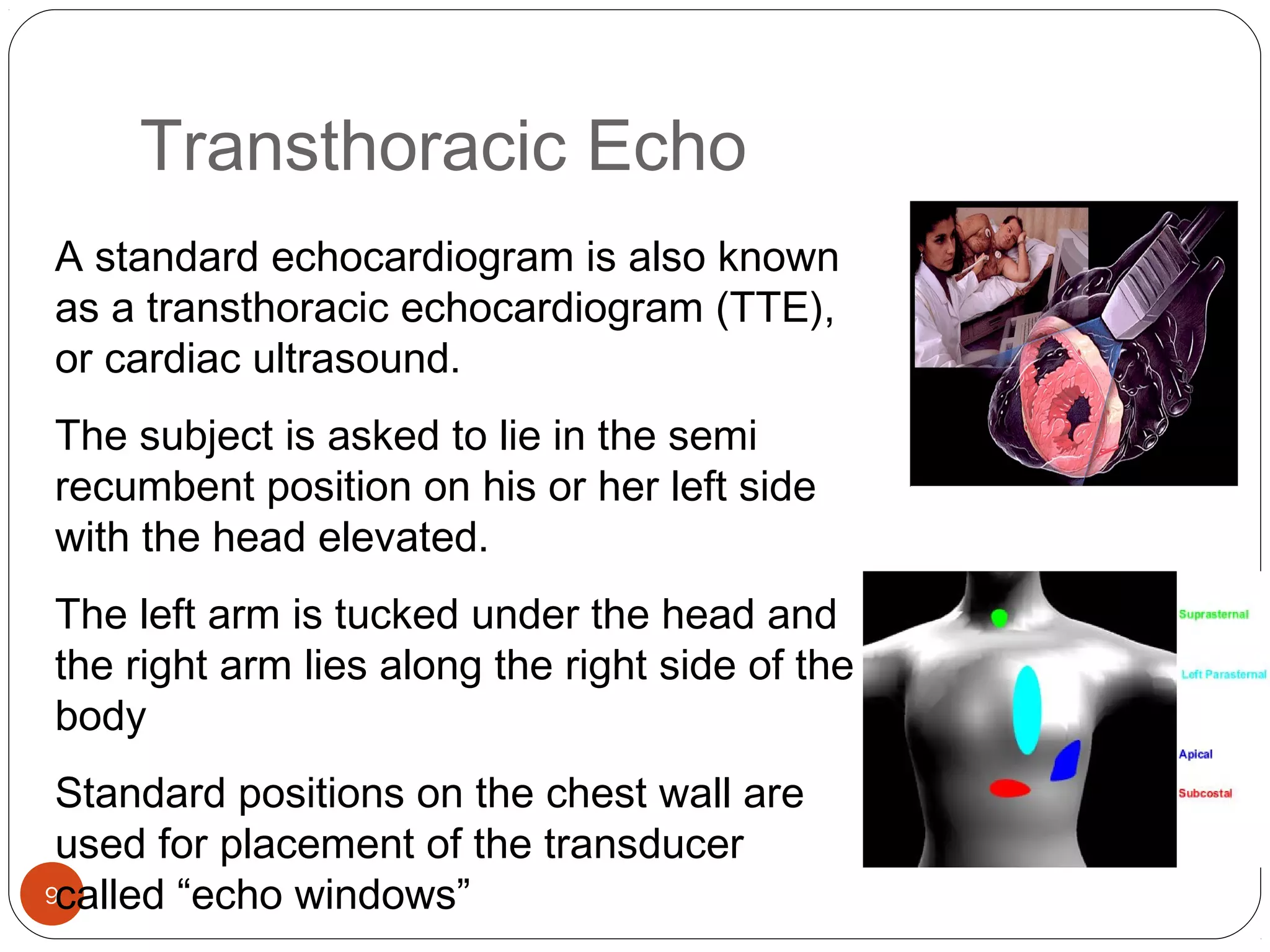 Transthoracic Echo 
A standard echocardiogram is also known 
as a transthoracic echocardiogram (TTE), 
or cardiac ultrasound. 
The subject is asked to lie in the semi 
recumbent position on his or her left side 
with the head elevated. 
The left arm is tucked under the head and 
the right arm lies along the right side of the 
body 
Standard positions on the chest wall are 
used for placement of the transducer 
called “echo windows” 
9 
 