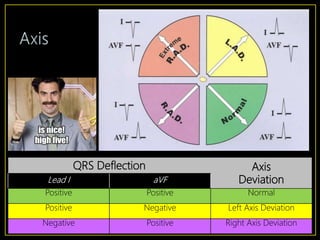 Introduction to EKG Interpretation | PPTX