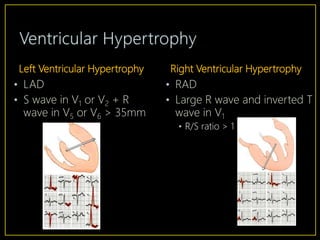 Introduction to EKG Interpretation | PPTX