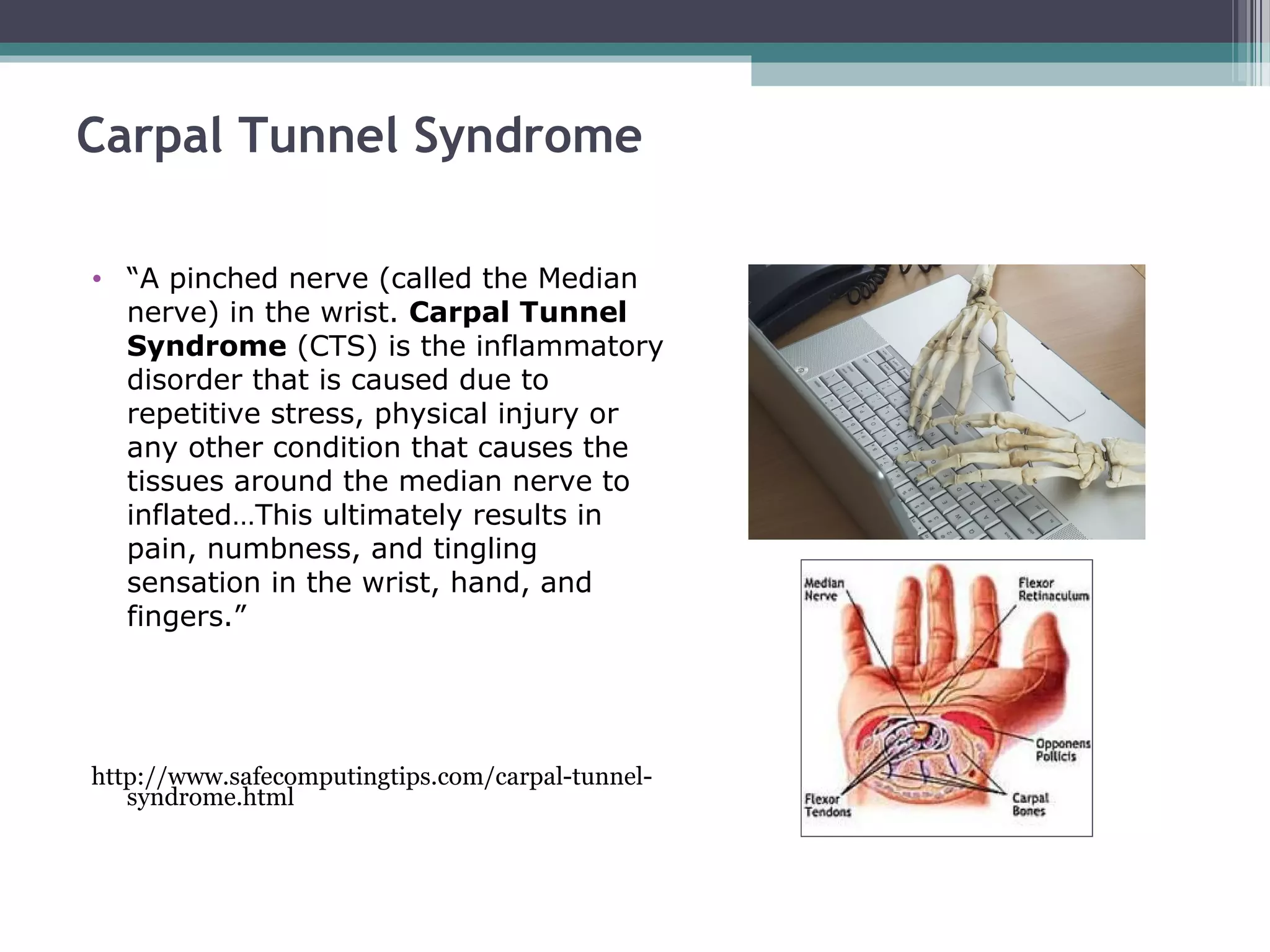 Carpal Tunnel Syndrome
• “A pinched nerve (called the Median
nerve) in the wrist. Carpal Tunnel
Syndrome (CTS) is the inflammatory
disorder that is caused due to
repetitive stress, physical injury or
any other condition that causes the
tissues around the median nerve to
inflated…This ultimately results in
pain, numbness, and tingling
sensation in the wrist, hand, and
fingers.”
http://www.safecomputingtips.com/carpal-tunnel-
syndrome.html
 