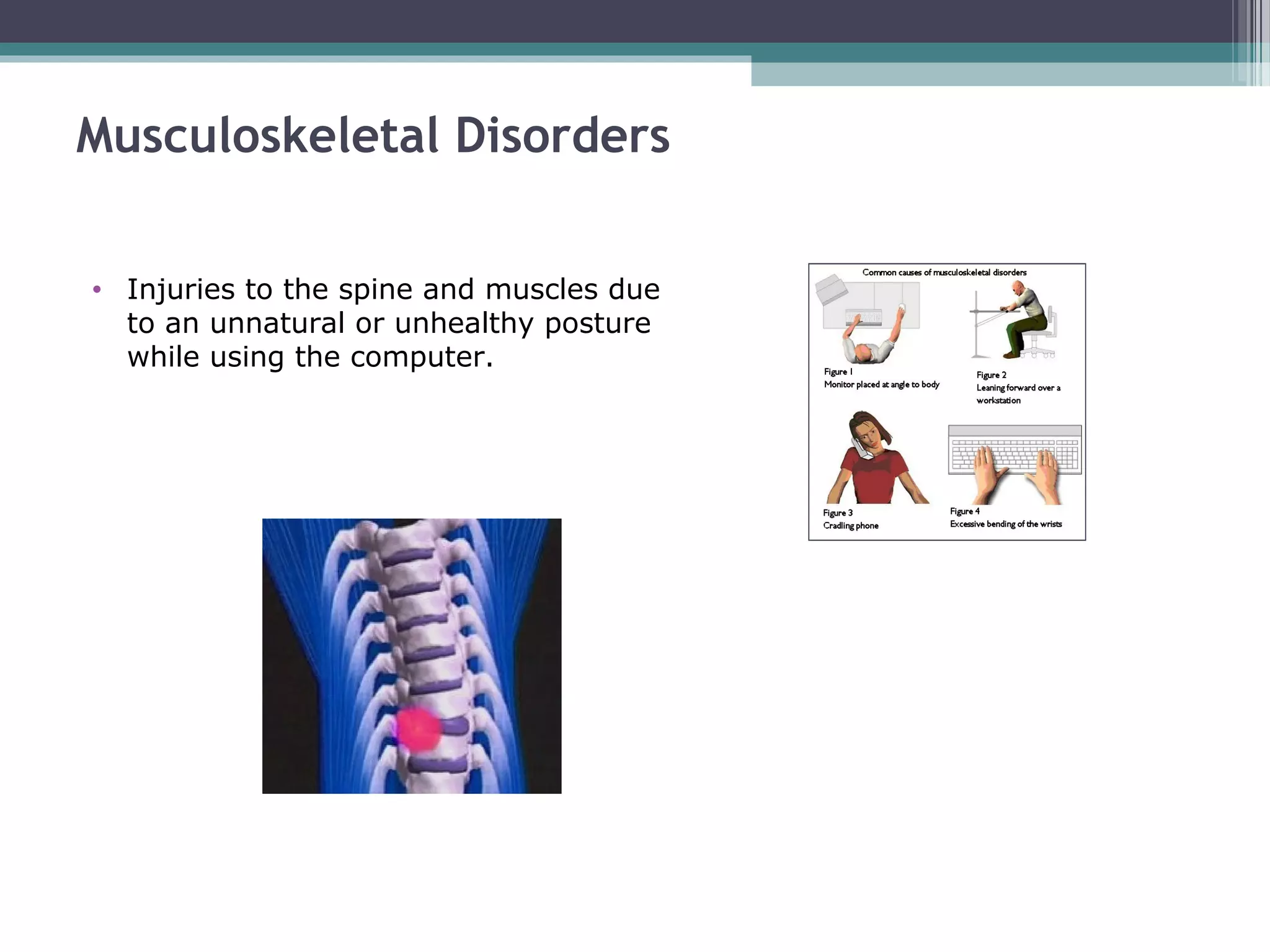 Musculoskeletal Disorders
• Injuries to the spine and muscles due
to an unnatural or unhealthy posture
while using the computer.
 