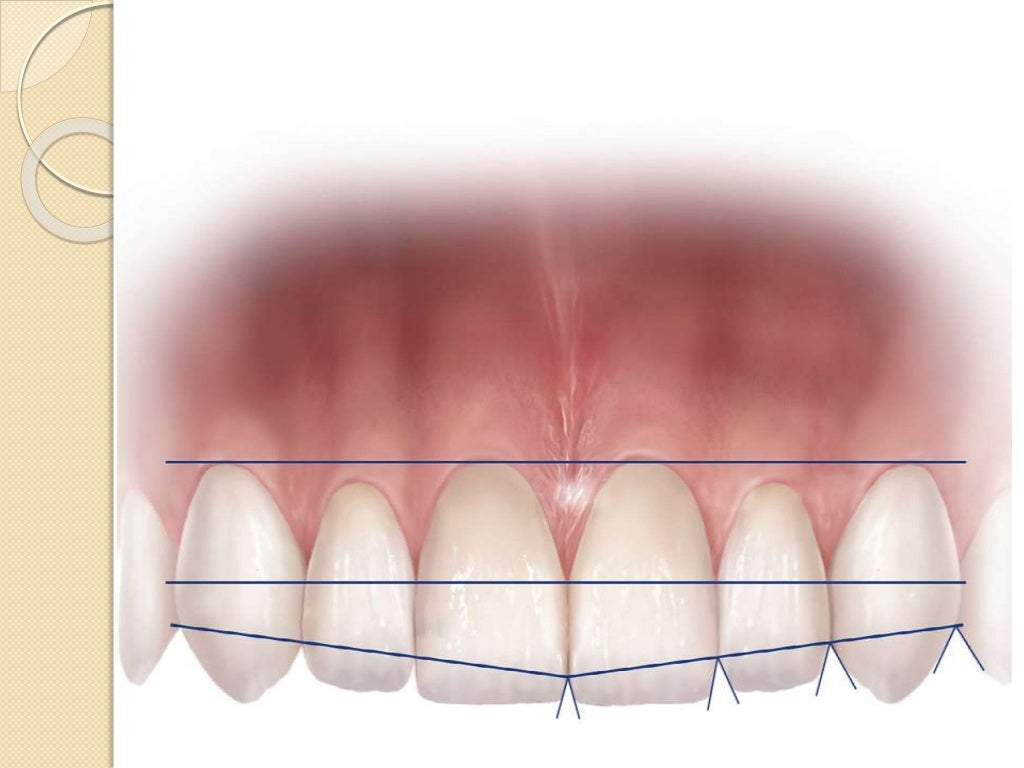 Introduction to esthetic dentistry