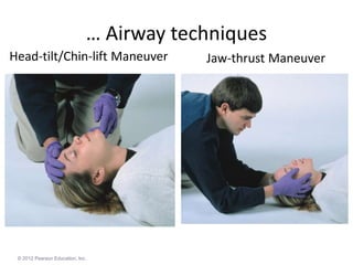 … Airway techniques
© 2012 Pearson Education, Inc.
Head-tilt/Chin-lift Maneuver Jaw-thrust Maneuver
 