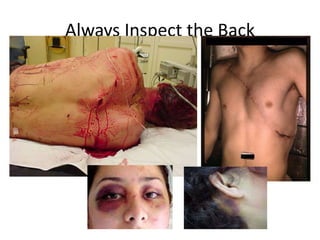 Always Inspect the Back
 