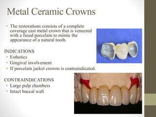 Metal Ceramic Crowns
• The restorations consists of a complete
coverage cast metal crown that is veneered
with a fused porcelain to mimic the
appearance of a natural tooth.
INDICATIONS
• Esthetics
• Gingival involvement
• If porcelain jacket crowns is contraindicated.
CONTRAINDICATIONS
• Large pulp chambers
• Intact buccal wall
 