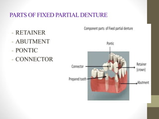 PARTS OF FIXED PARTIALDENTURE
- RETAINER
- ABUTMENT
- PONTIC
- CONNECTOR
 