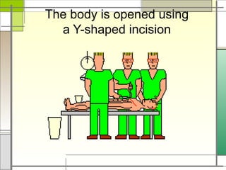The body is opened using
a Y-shaped incision
 