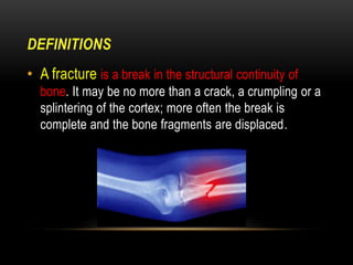 Fractures | PDF