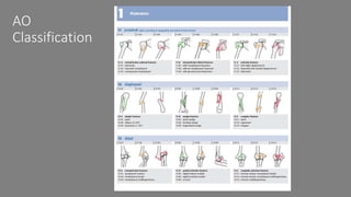 Introduction to fractures | PPTX