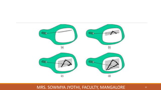 33
MRS. SOWMYA JYOTHI, FACULTY, MANGALORE
 