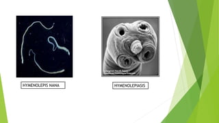 HYMENOLEPIS NANA HYMENOLEPIASIS
 