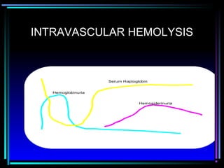 INTRAVASCULAR HEMOLYSIS
Serum Haptoglobin
Hemosiderinuria
Hemoglobinuria
 