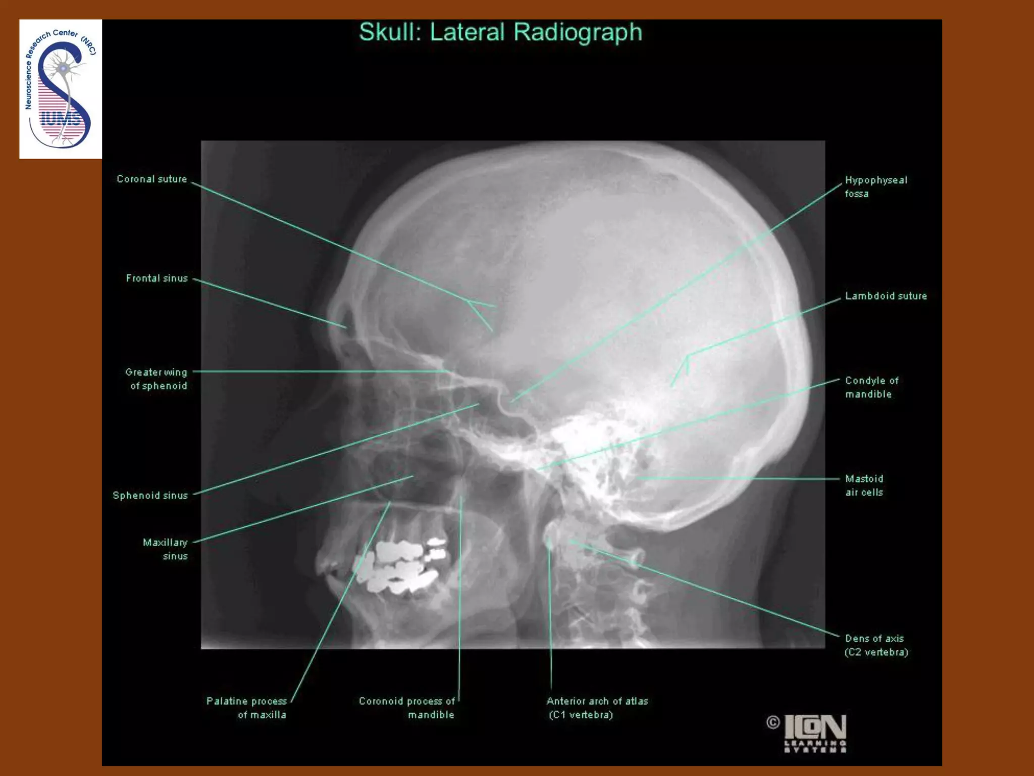 Introduction to human head & neck anatomy 1st sem 99 00 i | PPT