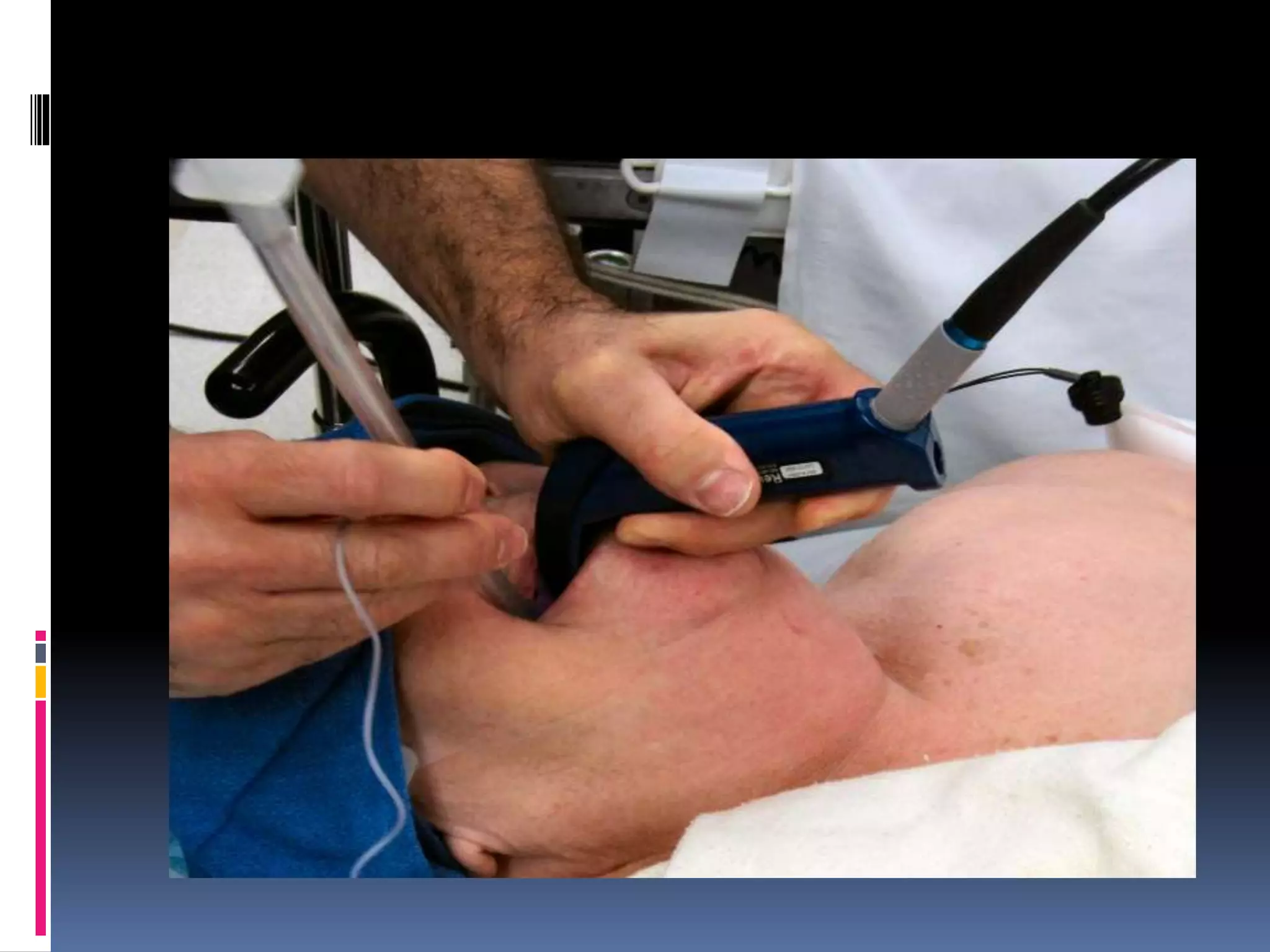 Introduction to ICU Basics in ICU | PPTX