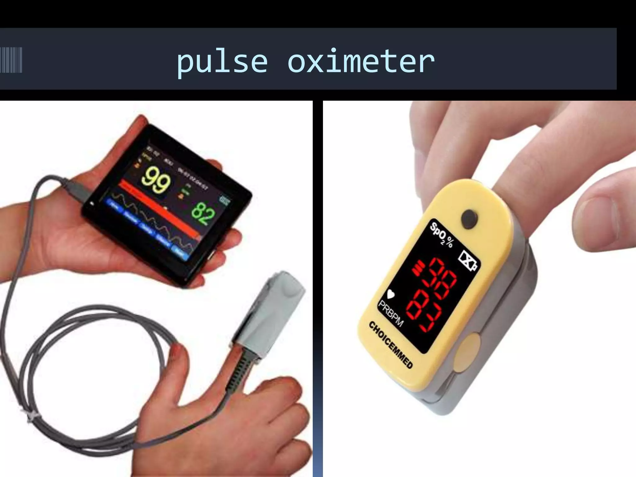 Introduction to ICU Basics in ICU | PPTX