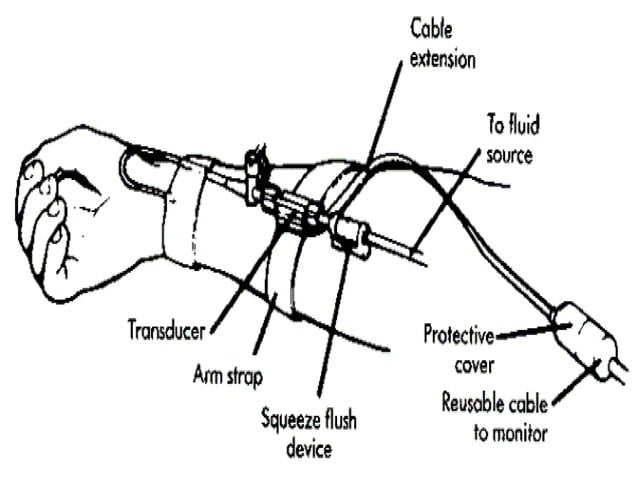 Introduction to ICU Basics in ICU | PPTX