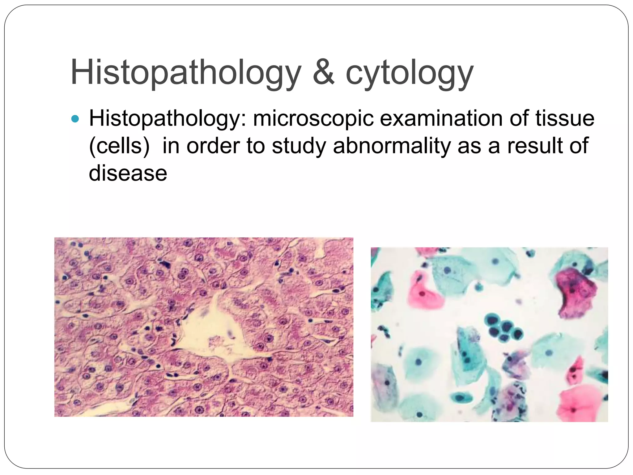Histopathology & cytology
 Histopathology: microscopic examination of tissue
(cells) in order to study abnormality as a result of
disease
 