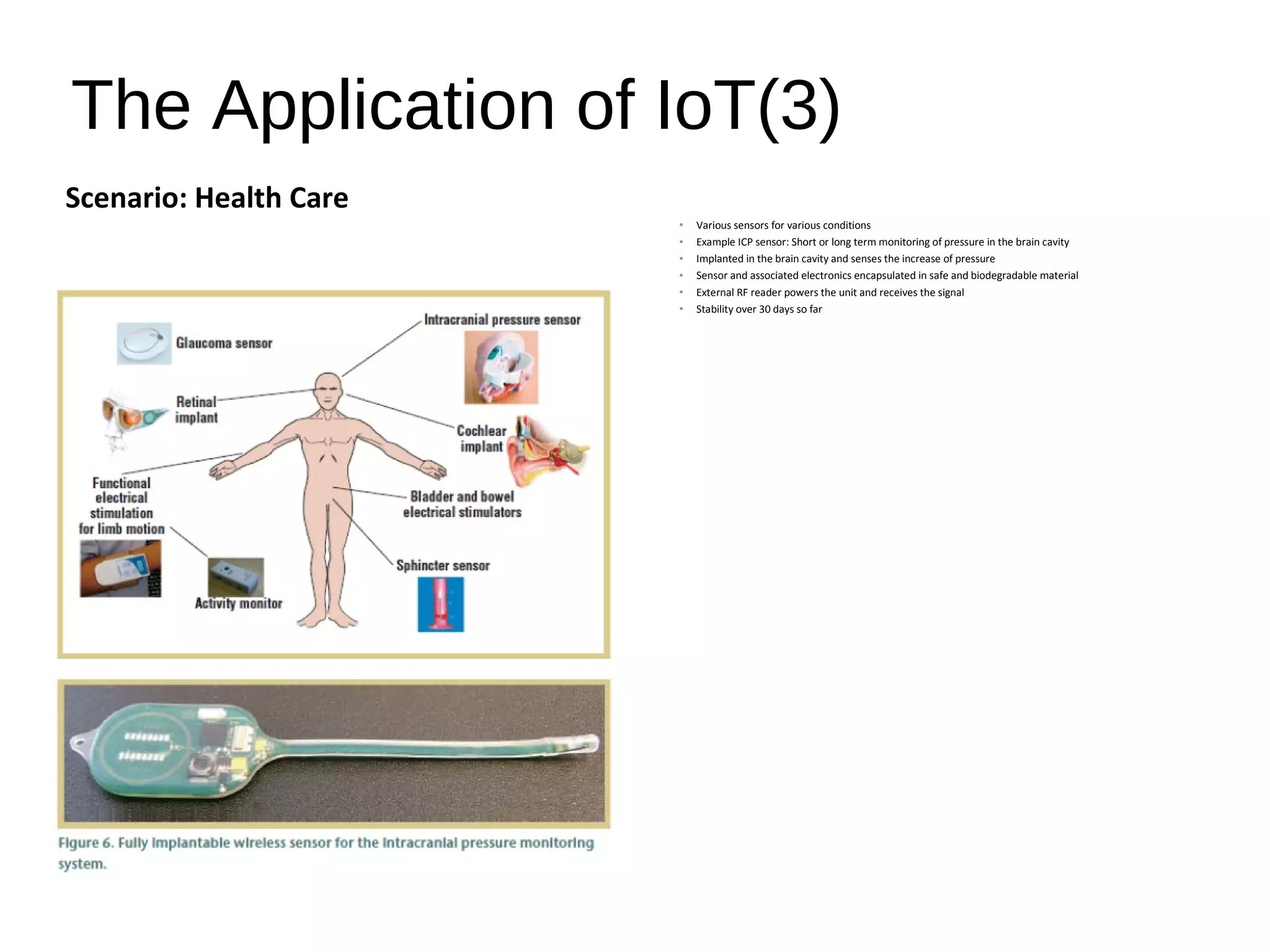 The Application of IoT(3)
Scenario: Health Care
• Various sensors for various conditions
• Example ICP sensor: Short or long term monitoring of pressure in the brain cavity
• Implanted in the brain cavity and senses the increase of pressure
• Sensor and associated electronics encapsulated in safe and biodegradable material
• External RF reader powers the unit and receives the signal
• Stability over 30 days so far
 