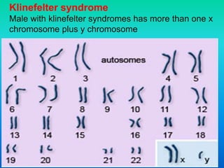Klinefelter syndrome
Male with klinefelter syndromes has more than one x
chromosome plus y chromosome
 