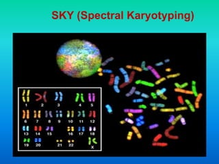 SKY (Spectral Karyotyping)
 