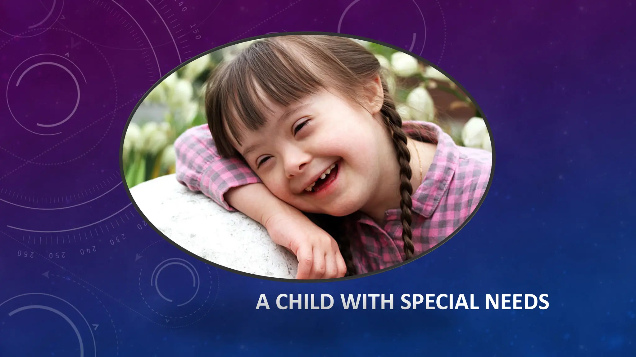A CHILD WITH SPECIAL NEEDS
 