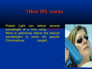Pulsed Light can deliver severalPulsed Light can deliver several
wavelength at a time usingwavelength at a time using "cut off""cut off"
filters to selectively deliver the desiredfilters to selectively deliver the desired
wavelengths to reach the specificwavelengths to reach the specific
Chromophore (target)Chromophore (target)
How IPL worksHow IPL works??
 
