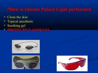 How is Intense Pulsed Light performedHow is Intense Pulsed Light performed??
 Clean the skinClean the skin
 Topical anestheticTopical anesthetic
 Soothing gelSoothing gel
 PROTECTIVE GOOGLES.PROTECTIVE GOOGLES.
 
