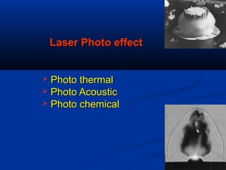 Laser Photo effectLaser Photo effect
 Photo thermalPhoto thermal
 Photo AcousticPhoto Acoustic
 Photo chemicalPhoto chemical
 