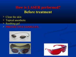 How is LASER performed?How is LASER performed?
Before treatmentBefore treatment
 Clean the skinClean the skin
 Topical anestheticTopical anesthetic
 Soothing gelSoothing gel
 PROTECTIVE GOOGLES.PROTECTIVE GOOGLES.
 