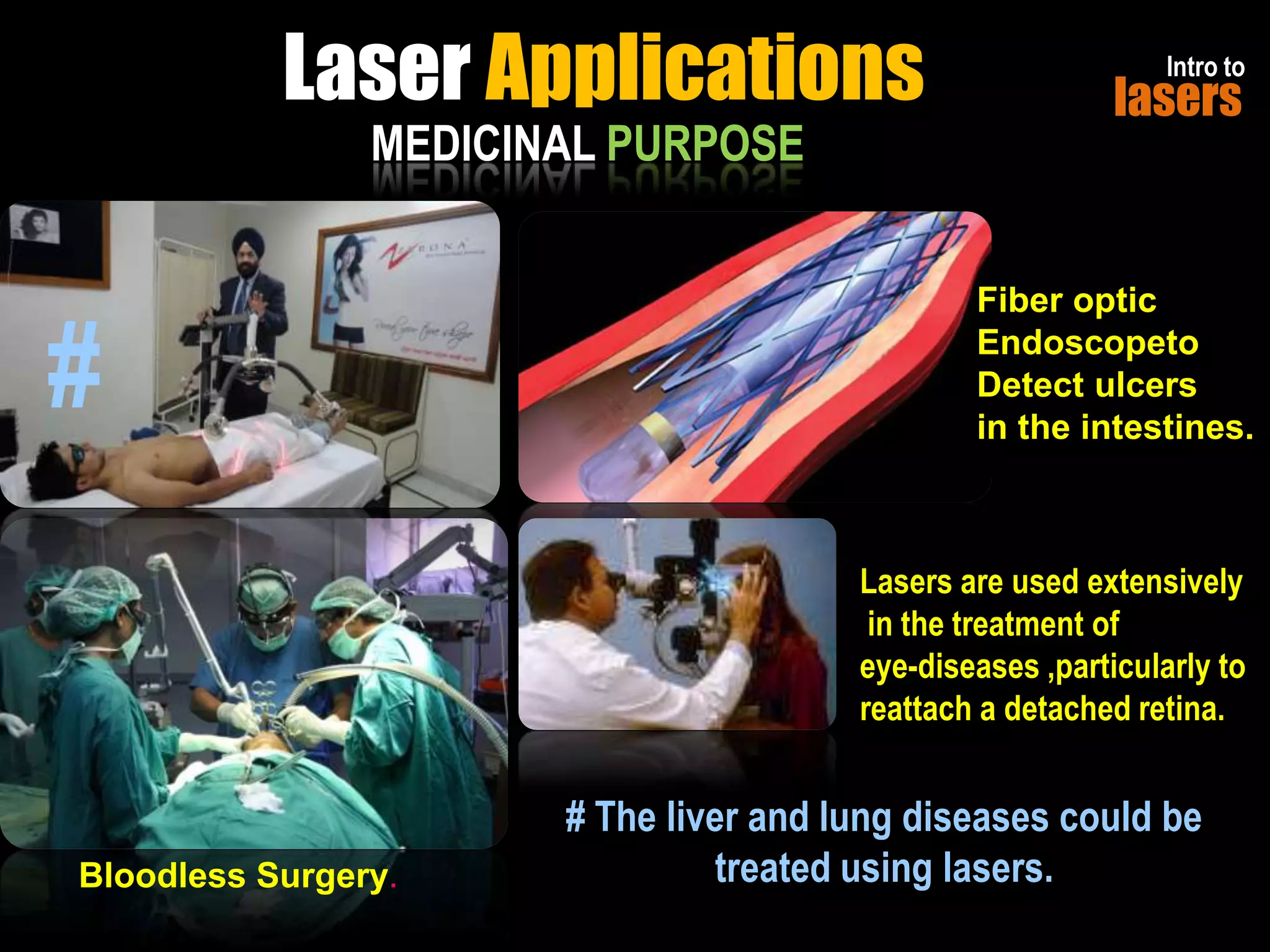 Introduction to Lasers